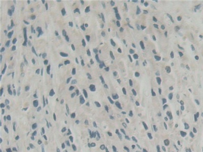 Polyclonal Antibody to Abl Interactor 1 (ABI1)