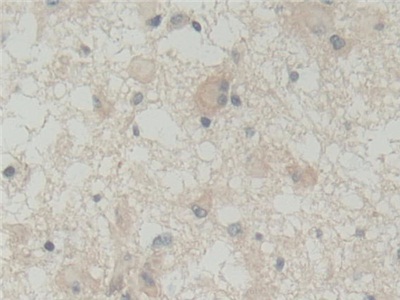 Polyclonal Antibody to Abl Interactor 1 (ABI1)