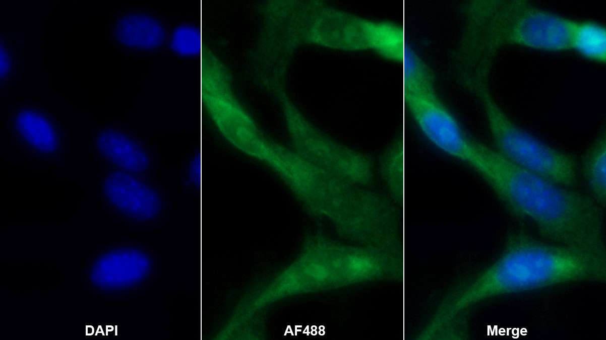 Polyclonal Antibody to GLI Family Zinc Finger Protein 3 (GLI3)