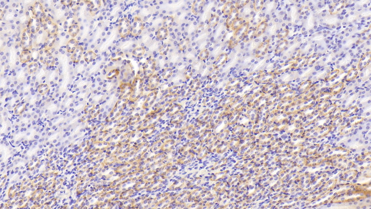 Polyclonal Antibody to Succinate Dehydrogenase Complex Subunit B (SDHB)