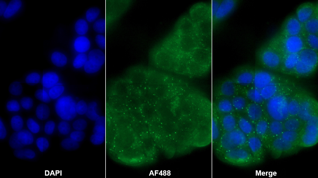 Polyclonal Antibody to Non Metastatic Cells 1, Protein NM23A Expressed In (NME1)