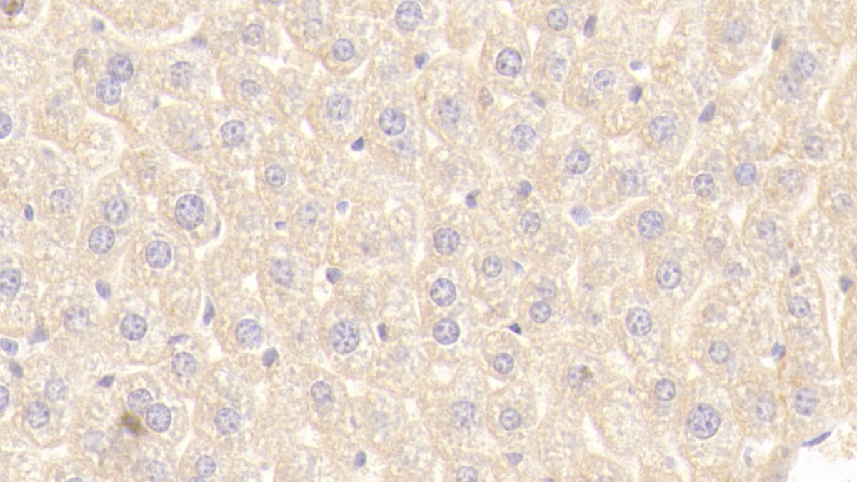 Polyclonal Antibody to Numb Homolog (NUMB)