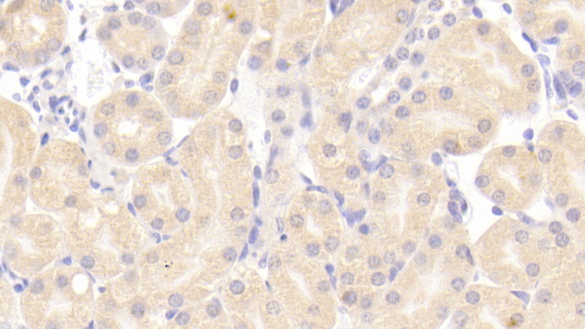 Polyclonal Antibody to Numb Homolog (NUMB)