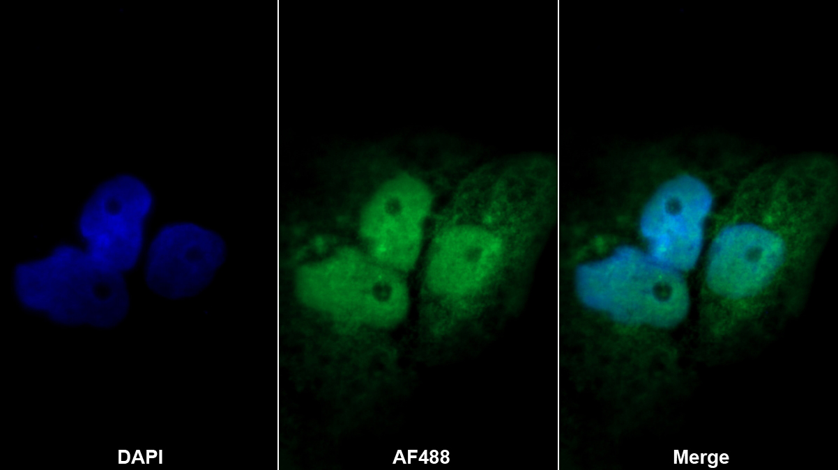 Polyclonal Antibody to Fas Associating Death Domain Containing Protein (FADD)