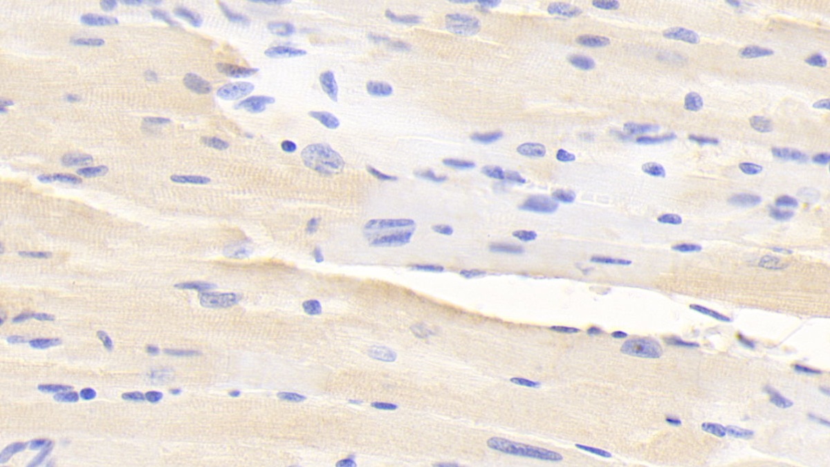 Polyclonal Antibody to A Disintegrin And Metalloproteinase With Thrombospondin 2 (ADAMTS2)