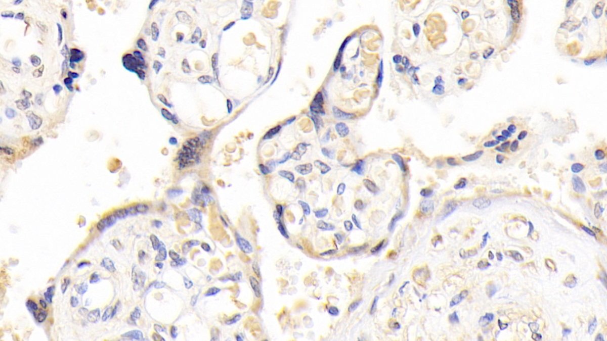 Polyclonal Antibody to A Disintegrin And Metalloprotease 12 (ADAM12)