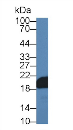 Polyclonal Antibody to Non Metastatic Cells 3, Protein NM23A Expressed In (NME3)