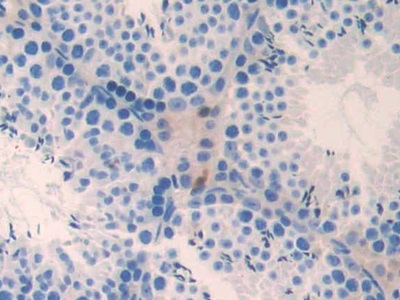 Polyclonal Antibody to Non Metastatic Cells 3, Protein NM23A Expressed In (NME3)