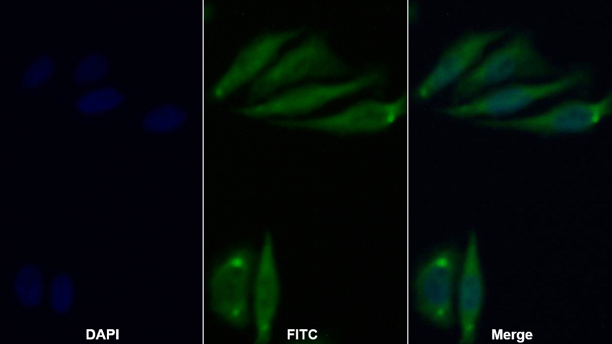 Polyclonal Antibody to Pentraxin 3, Long (PTX3)