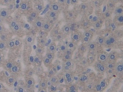 Polyclonal Antibody to Pentraxin 3, Long (PTX3)
