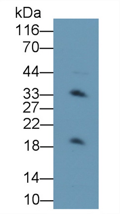 Polyclonal Antibody to Transmembrane Protein 27 (TMEM27)