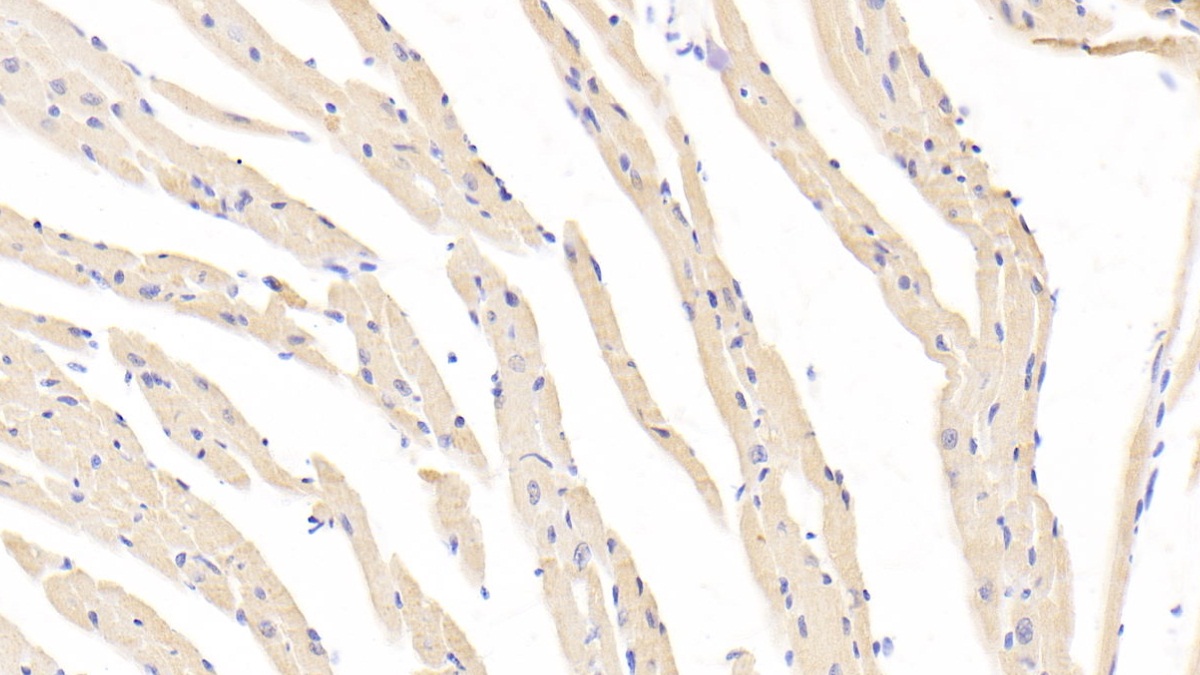 Polyclonal Antibody to Sprouty Homolog 2 (SPRY2)