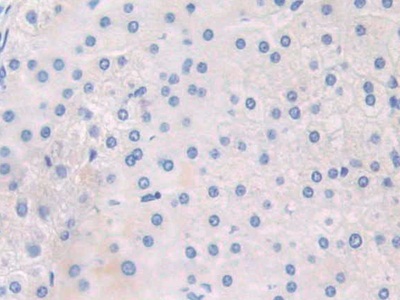 Polyclonal Antibody to Adaptor Protein Phosphotyrosine Interaction PH Domain And leucine Zipper Containing Protein 1 (APPL1)