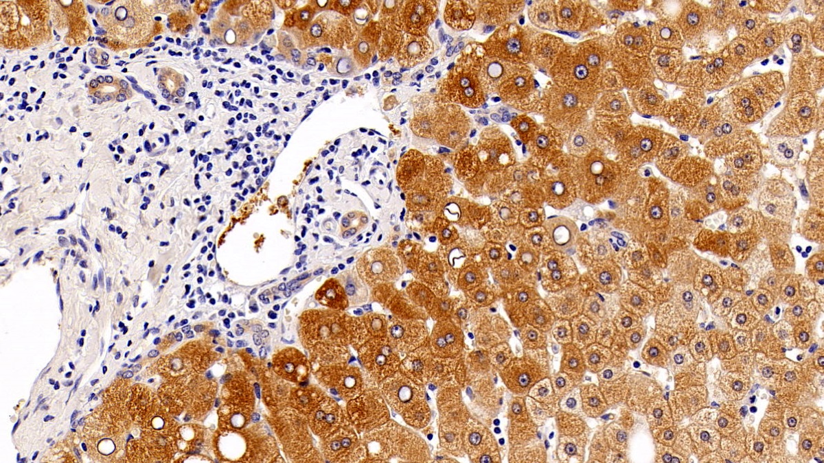 Polyclonal Antibody to Autophagy Related Protein 5 (ATG5)
