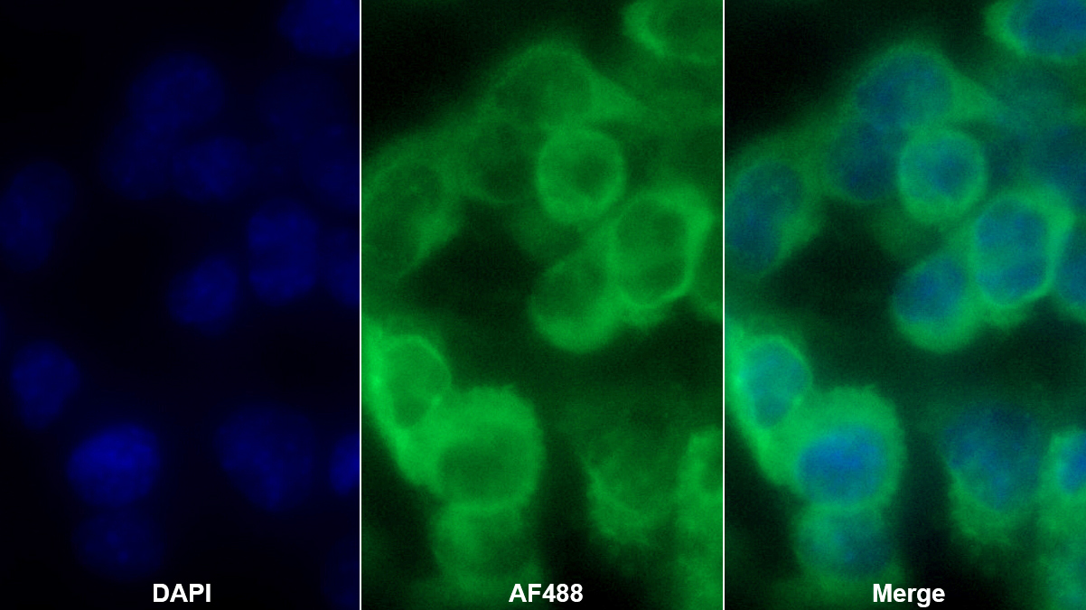 Polyclonal Antibody to CD2 Associated Protein (CD2AP)