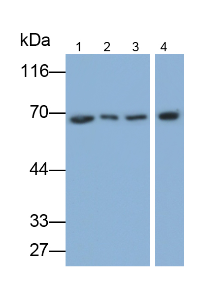 Polyclonal Antibody to DEAD Box Polypeptide 5 (DDX5)