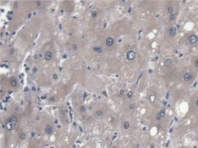 Polyclonal Antibody to Endoplasmic Reticulum Lipid Raft Associated Protein 2 (ERLIN2)