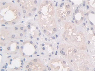Polyclonal Antibody to Hermansky Pudlak Syndrome Protein 4 (HPS4)