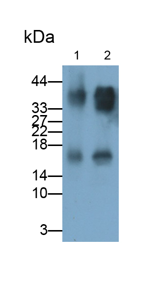 Polyclonal Antibody to Interleukin 1 Family, Member 9 (IL1F9)