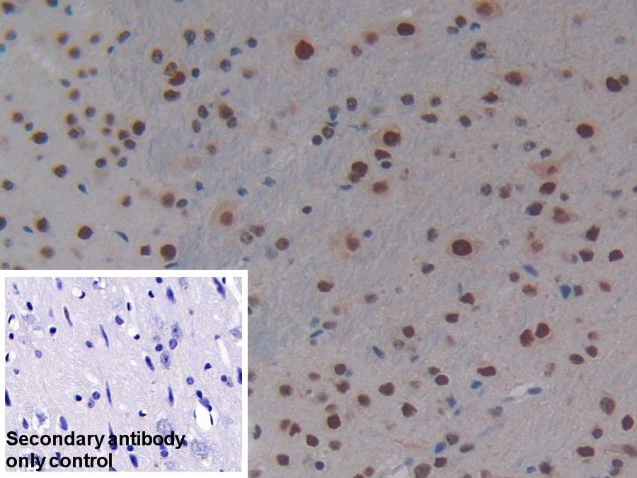 Polyclonal Antibody to KH Domain Containing, RNA Binding, Signal Transduction Associated Protein 1 (KHDRBS1)