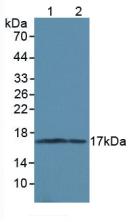 Polyclonal Antibody to Microtubule Associated Protein 1 Light Chain 3 Alpha (MAP1LC3a)