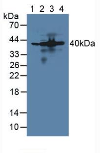 Polyclonal Antibody to Aminoacyl tRNA Synthetase Complex Interacting Multifunctional Protein 1 (AIMP1)