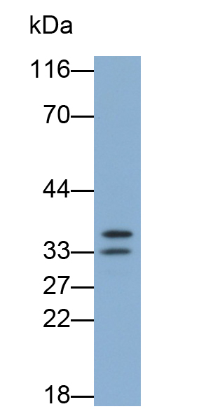 Polyclonal Antibody to Otubain 1 (OTUB1)