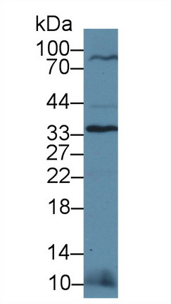 Polyclonal Antibody to Otubain 1 (OTUB1)