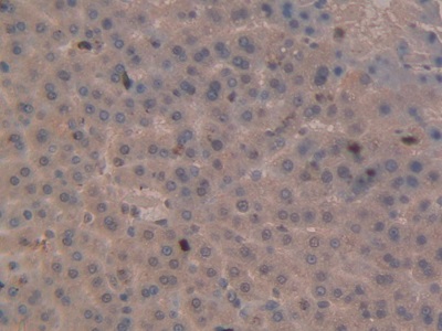 Polyclonal Antibody to Otubain 1 (OTUB1)