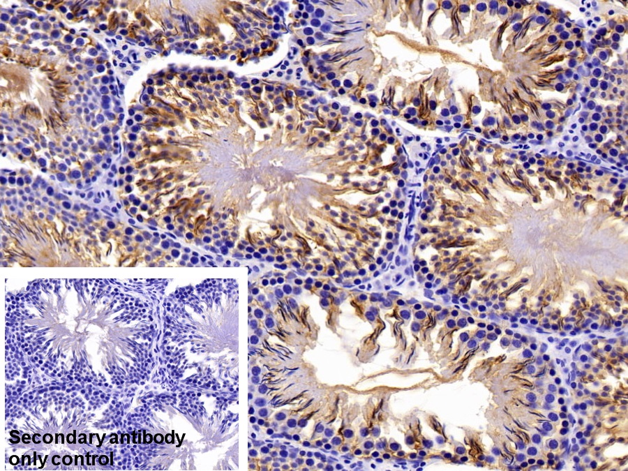 Polyclonal Antibody to Otubain 1 (OTUB1)