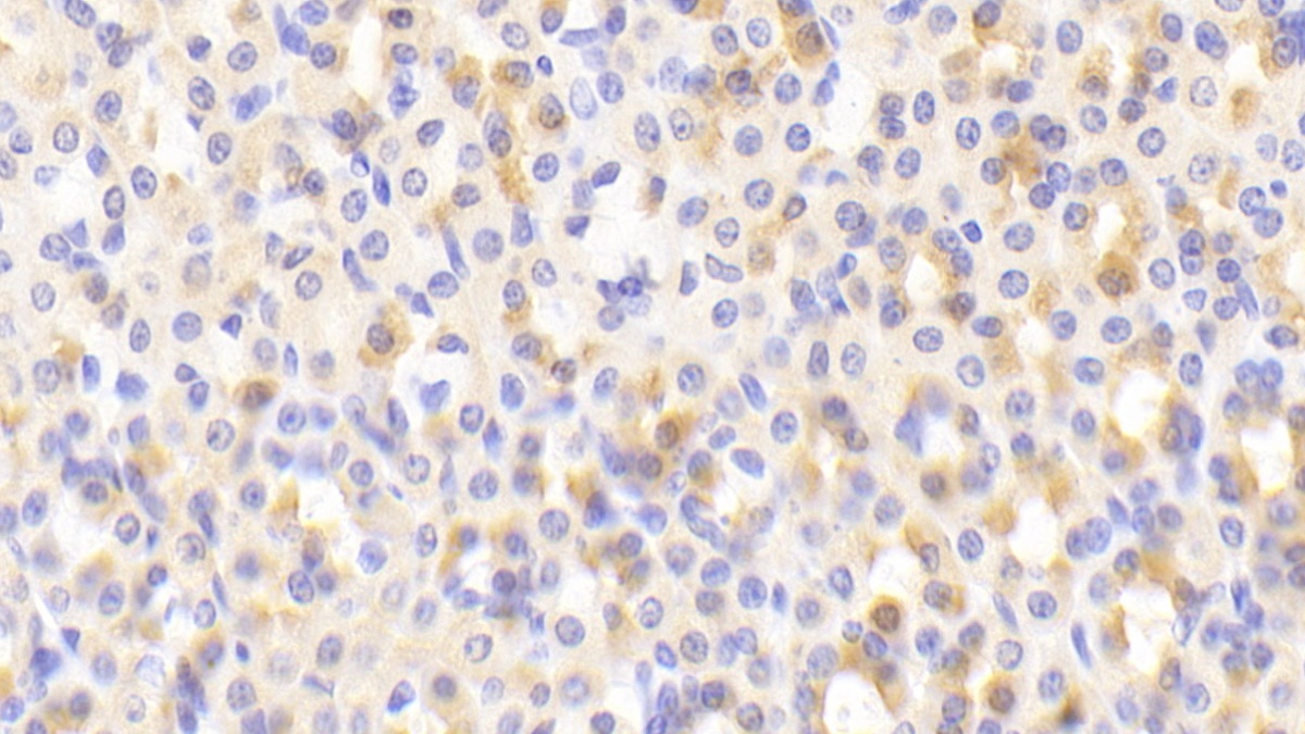 Polyclonal Antibody to Nuclear Factor, Erythroid Derived 2 Like Protein 2 (NFE2L2)