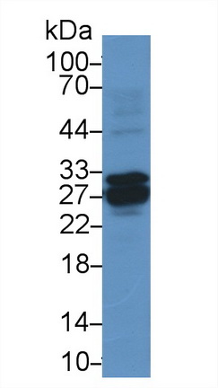 Polyclonal Antibody to NADH Dehydrogenase, Quinone 1 (NQO1)
