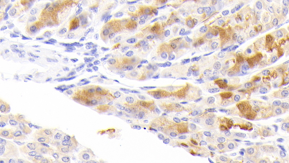 Polyclonal Antibody to Resistin Like Beta (RETNLb)