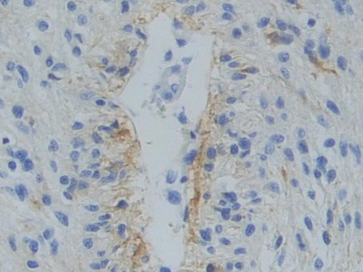 Polyclonal Antibody to Src Homology 2 Domain Containing Adapter Protein B (SHB)