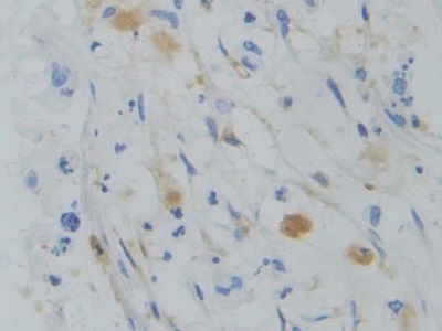 Polyclonal Antibody to Src Homology 2 Domain Containing Adapter Protein B (SHB)