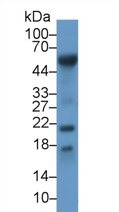 Polyclonal Antibody to Retinol Binding Protein 7, Cellular (RBP7)