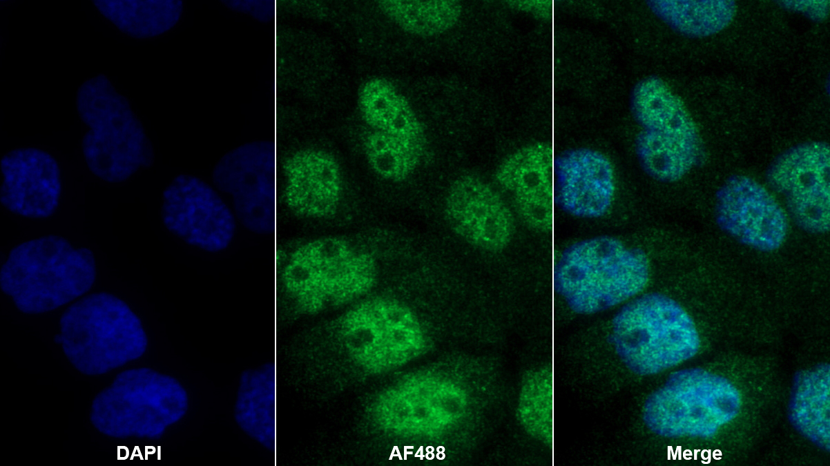 Polyclonal Antibody to Normal Mucosa Of Esophagus Specific 1 (NMES1)