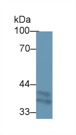 Polyclonal Antibody to Transmembrane Protein 173 (TMEM173)