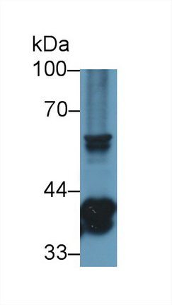 Polyclonal Antibody to Transmembrane Protein 173 (TMEM173)