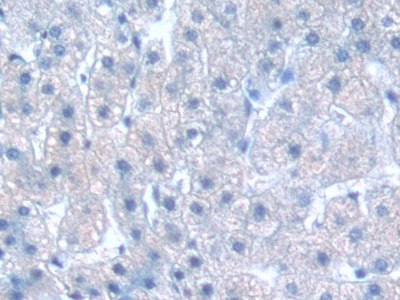 Polyclonal Antibody to G Protein Beta Subunit Like Protein (GbL)