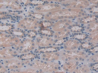 Polyclonal Antibody to G Protein Beta Subunit Like Protein (GbL)