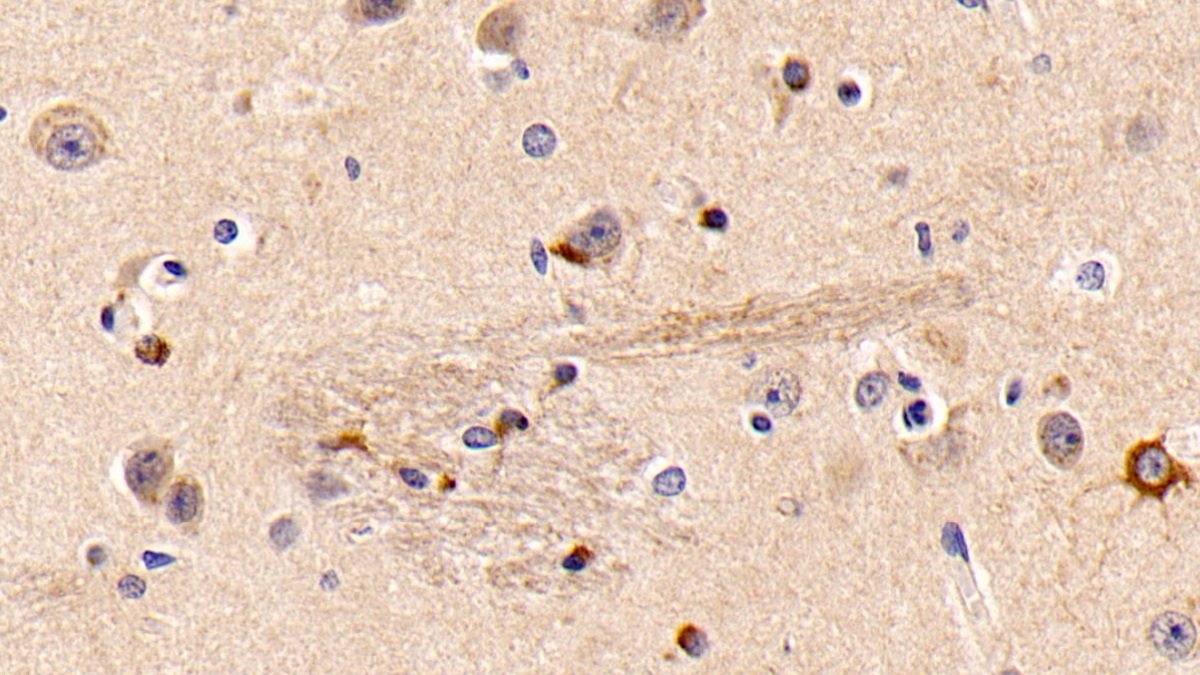 Polyclonal Antibody to G Protein Beta Subunit Like Protein (GbL)