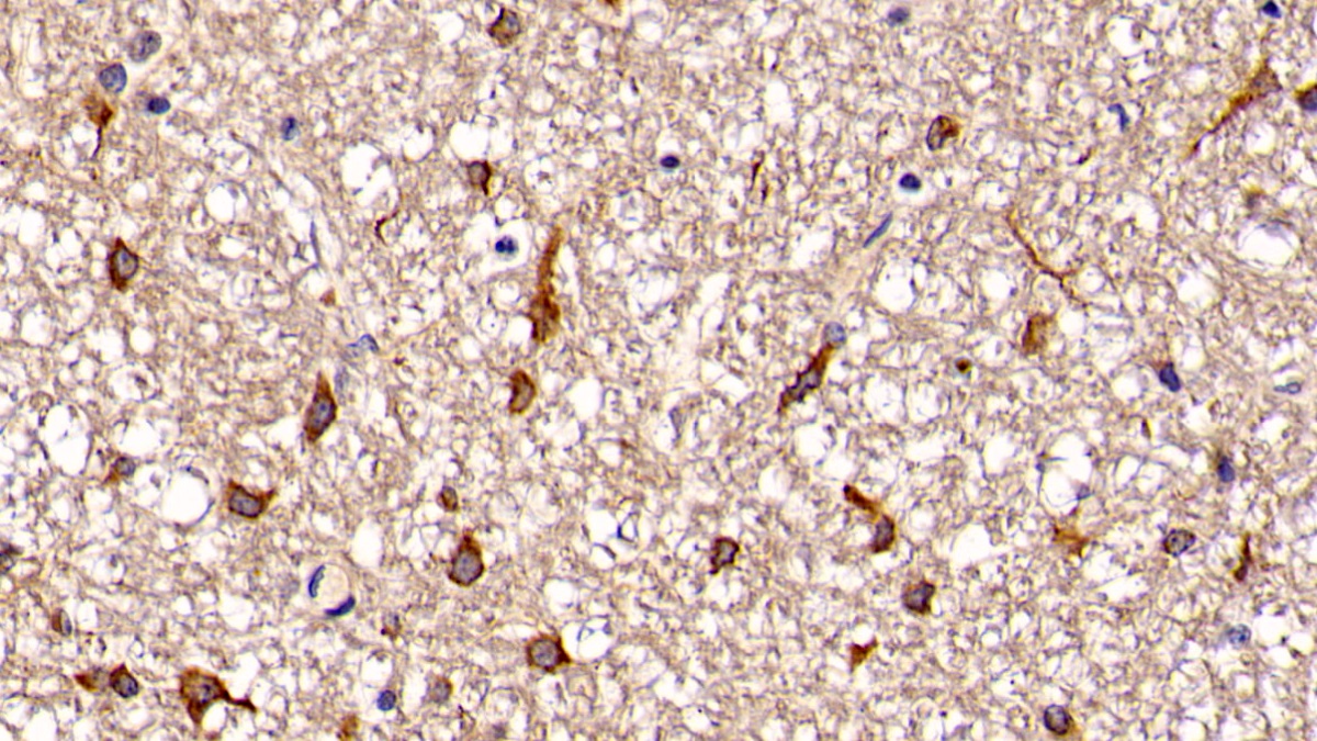 Polyclonal Antibody to G Protein Beta Subunit Like Protein (GbL)