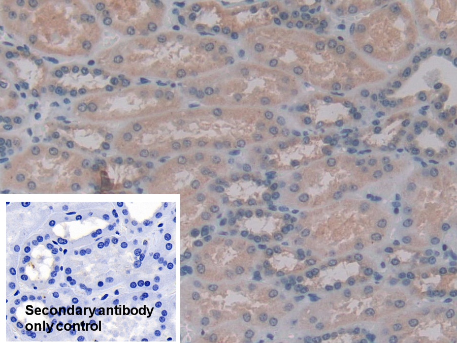 Polyclonal Antibody to G Protein Beta Subunit Like Protein (GbL)