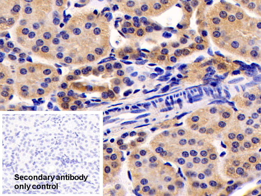 Polyclonal Antibody to G Protein Beta Subunit Like Protein (GbL)