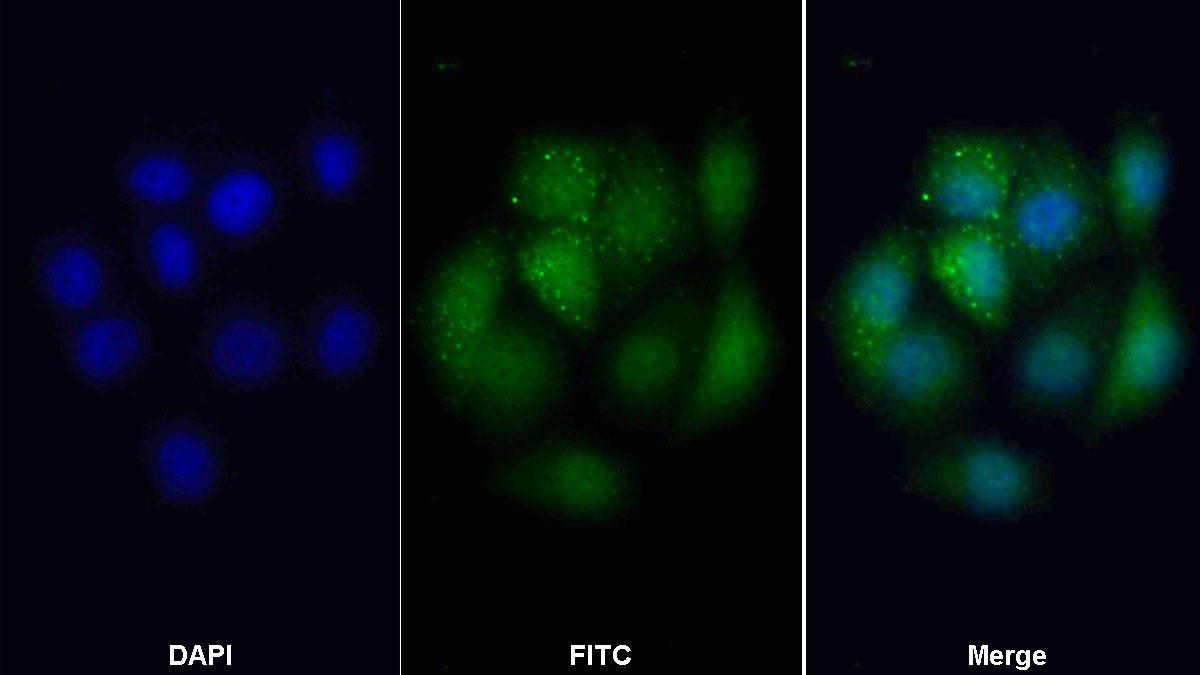 Polyclonal Antibody to G Protein Beta Subunit Like Protein (GbL)