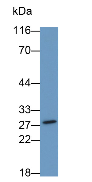 Polyclonal Antibody to G Protein Beta Subunit Like Protein (GbL)