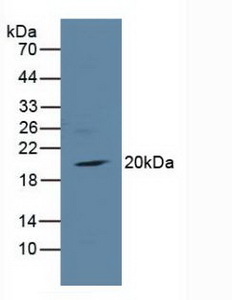 Polyclonal Antibody to Toll Interleukin 1 Receptor Domain Containing Adaptor Protein (TIRAP)