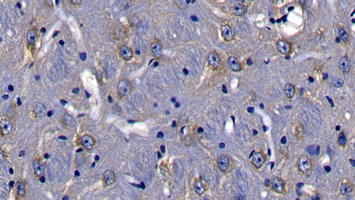 Polyclonal Antibody to Toll Interleukin 1 Receptor Domain Containing Adaptor Protein (TIRAP)