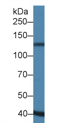 Polyclonal Antibody to A Disintegrin And Metalloproteinase With Thrombospondin 19 (ADAMTS19)